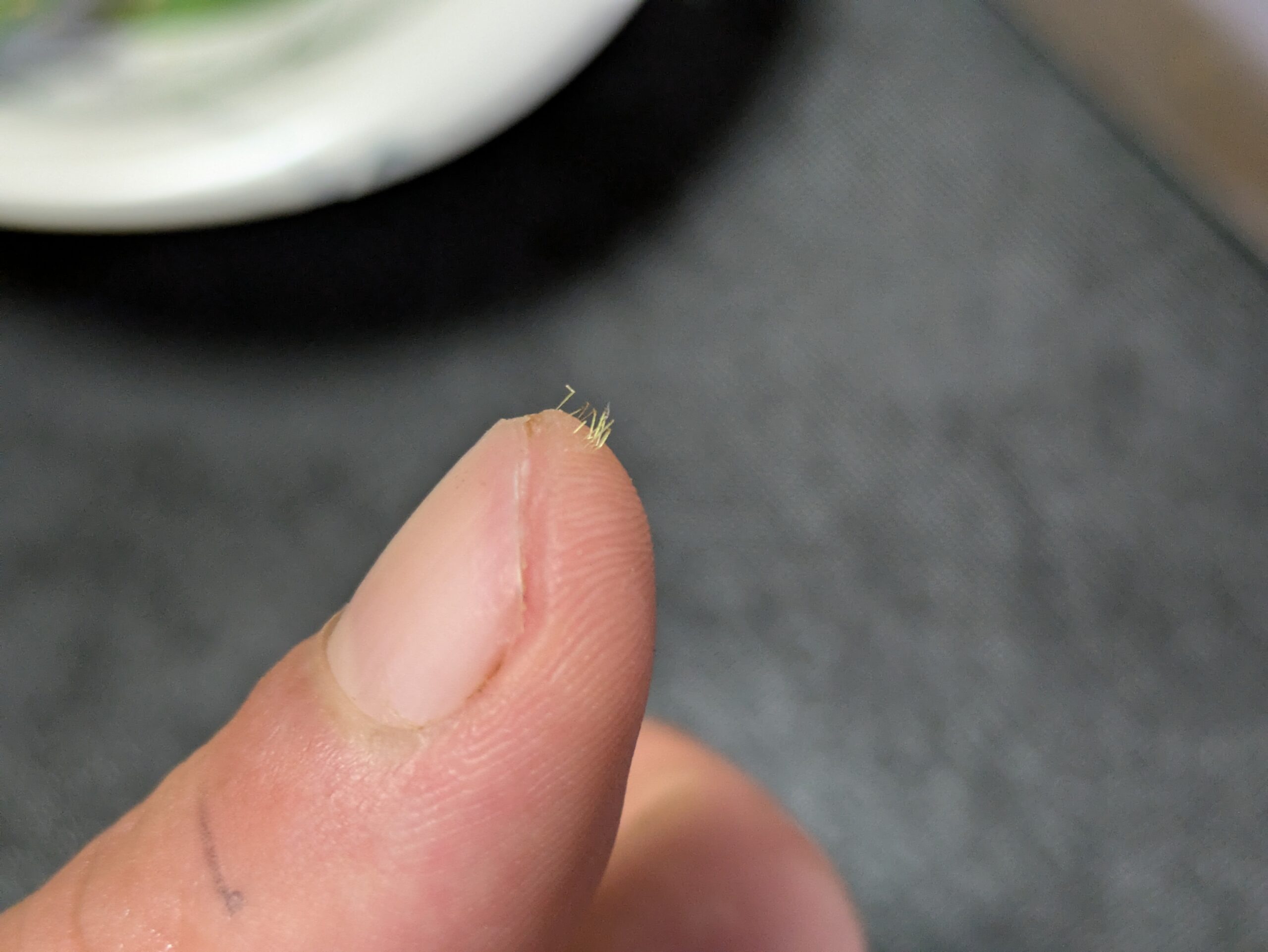 指先に付着したウチワサボテンの細かいトゲ